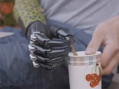 奧托博克Myo Plus多電極智能仿生手