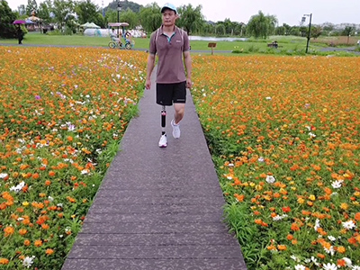 單大腿假肢走路實(shí)拍