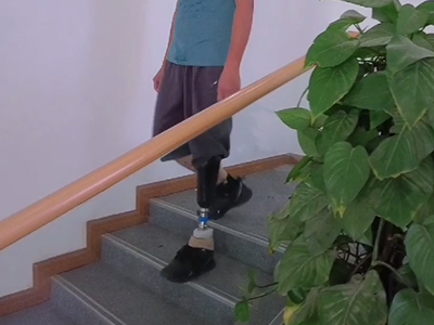 單小腿假肢走路實(shí)拍